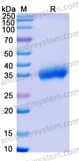 Recombinant SARS-CoV-2 RBD (P.1) Protein, C-His