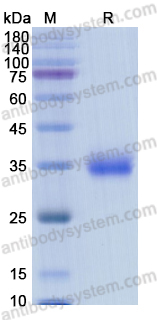 Recombinant SARS-CoV-2 RBD (B.1.427/B.1.429) Protein, C-His