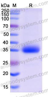 Recombinant SARS-CoV-2 RBD (B.1.617.2) Protein, C-His