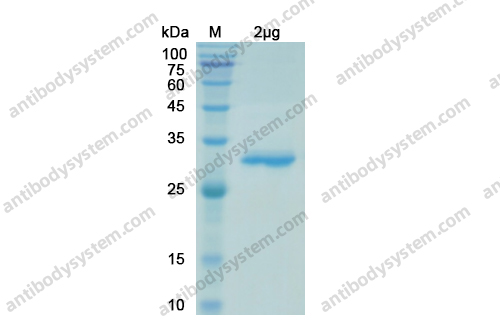 Recombinant SARS-CoV-2 RBD Protein, C-His