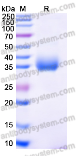 Recombinant SARS-CoV-2 RBD (Mu) Protein, C-His