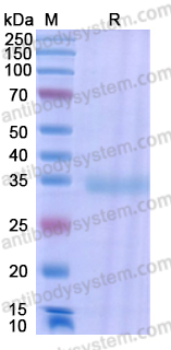 Recombinant SARS-CoV-2 RBD (Lambda) Protein, C-His