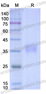 Recombinant SARS-CoV-2 RBD (WT) Protein, No Tag