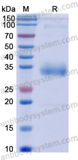 Recombinant SARS-CoV-2 RBD (B.1.351: K417N, E484K, N501Y) Protein, No Tag