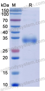 Recombinant SARS-CoV-2 RBD (B.1.617.2) Protein, No Tag