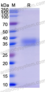 Recombinant SARS-CoV-2 RBD (Omicron/B.1.1.529) Protein, C-His