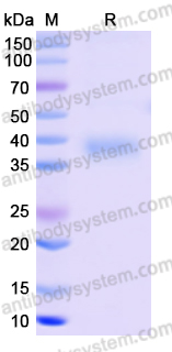 Recombinant SARS-CoV-2 RBD (Omicron/BA.4) Protein, C-His