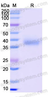 Recombinant SARS-CoV-2 RBD (Omicron/BA.5) Protein, C-His