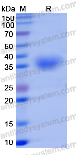 Recombinant SARS-CoV-2 RBD (Omicron/BA.2.75) Protein, C-His