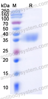 Recombinant SARS-CoV-2 RBD (Omicron XBB.1.5) Protein, C-His