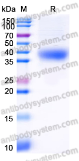 Recombinant SARS-CoV-2 RBD (Omicron_BF.7) Protein, C-His