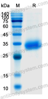 Recombinant SARS-CoV-2 RBD (Val367Phe) Protein, C-His