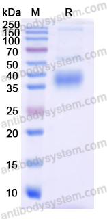 Recombinant SARS-CoV-2 Spike (RBD) Protein (BA.2.86), C-His