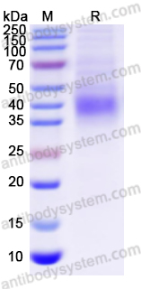 Recombinant SARS-CoV-2 RBD (KP.2) Protein, C-His