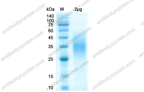 Recombinant SARS-CoV-2 S2 Protein, C-His