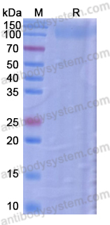 Recombinant HIV2 Surface protein gp120 Protein, C-His