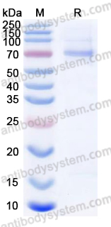 Recombinant Influenza A virus (H3N2) NP/Nucleoprotein Protein, C-His