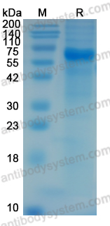 Recombinant Rabies virus/RABV G/Glycoprotein Protein, C-His