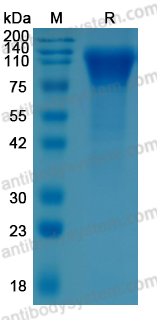 Recombinant ZEBOV GP1 Protein, C-His
