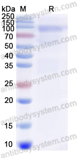 Recombinant Influenza A virus (H5N1) HA/Hemagglutinin Protein, C-His