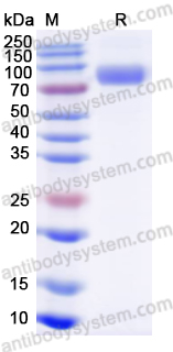 Recombinant Influenza A virus (H1N1) HA/Hemagglutinin Protein, C-His