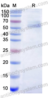 Recombinant Lyssavirus rabies G/Glycoprotein Protein, C-His