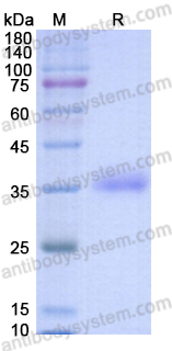 Recombinant MERS-CoV S/Spike glycoprotein Protein, C-His