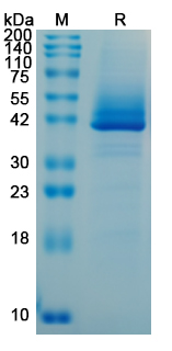 Recombinant CHIKV Spike glycoprotein E2 Protein, C-His