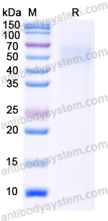 Recombinant Monkeypox virus/MPXV HA/B2R Protein, C-His