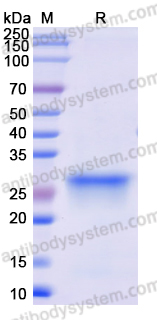 Recombinant Monkeypox virus/MPXV D14L Protein, C-His