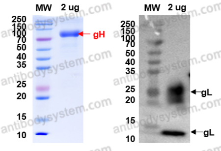 Recombinant EBV/HHV4 gH & gL Complex Protein, C-Strep & C-His