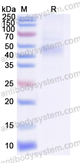 Recombinant EBV/HHV-4 gH/BXLF2 Protein, C-His