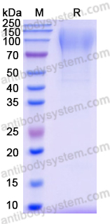 Recombinant EBV/HHV4 BLLF1/MA/GP350 Protein, C-His