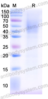 Recombinant Monkeypox virus/MPXV A5L Protein, C-His