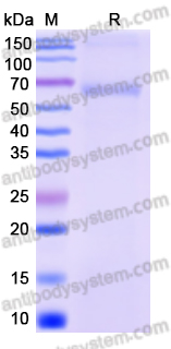 Recombinant Langya virus/LayV F/Fusion Protein, C-His