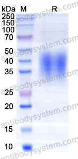 Recombinant EBV/HHV4 GP42/Glycoprotein 42 Protein, C-His