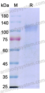 Recombinant PEDV S/Spike glycoprotein Protein, C-His