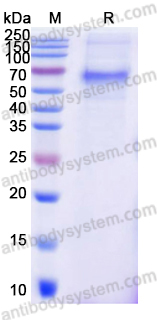 Recombinant Dabie bandavirus M polyprotein Protein, C-6His