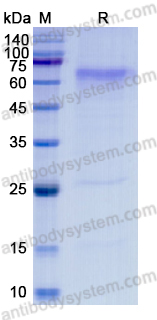 Recombinant SFTS phlebovirus Glycoprotein C/Gc Protein, C-His