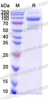 Recombinant Influenza D virus (Flu D) HE Protein, C-His