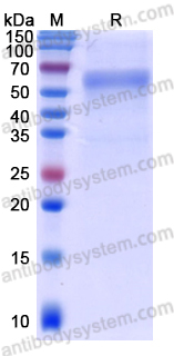 Recombinant ASFV P30/CP204L Protein, N-Fc