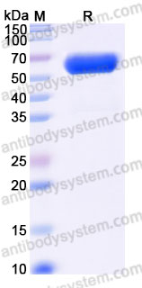 Recombinant Rhesus monkey CD167a/DDR1 Protein, C-His