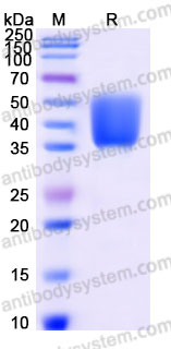 Recombinant Rhesus monkey CDw210a/IL10RA Protein, C-His