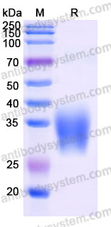 Recombinant Cynomolgus monkey TREM2 Protein, C-His