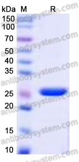 Recombinant Escherichia coli tetR Protein, N-His