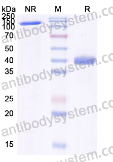 Anti-Human CXCL11/I-TAC Antibody (SAA0466)