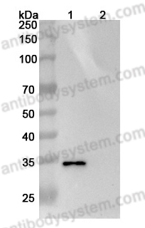 Anti-Human CD205/LY75 Antibody (A1)