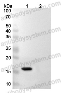 Anti-Human IL1B/IL1F2 Antibody (SAA0369)