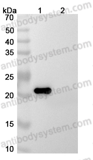 Anti-Human IL6 Antibody (SAA0375)