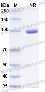 Anti-Human ADRB1 Antibody (6B9)